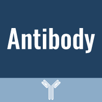 SARS-CoV / SARS-CoV-2 Spike Antibody, Rabbit PAb, Antigen Affinity Purified