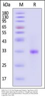 SARS-CoV-2 3C-like Proteinase Protein, Tag Free (active enzyme, MALS verified)