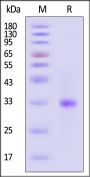 SARS-CoV-2 3C-like Proteinase Protein, Tag Free (active enzyme, MALS verified)