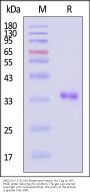 SARS-CoV-2 3C-like Proteinase Protein, His Tag (active enzyme, MALS verified)