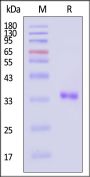 SARS-CoV-2 3C-like Proteinase Protein, His Tag (active enzyme, MALS verified)