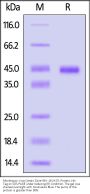 Monkeypox virus (strain Zaire-96-I-16) A17L Protein, His Tag (HPLC verified)