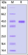 Monkeypox virus (strain Zaire-96-I-16) A17L Protein, His Tag (HPLC verified)