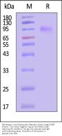 Monkeypox virus (Democratic Republic of the Congo) A33R Protein, Twin-Streptavidin Tag&His Tag