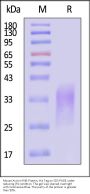 Mouse Activin RIIB / ACVR2B Protein, His Tag (MALS & SPR verified)