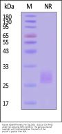 Human ADAM9 Protein, His Tag (206 - 413) (active enzyme)