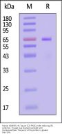 Human ADAM9 Protein, His Tag (active enzyme)