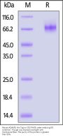 Mouse ADAM9 Protein, His Tag (active enzyme, MALS verified)