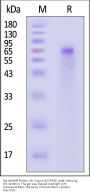 Rat ADAM9 Protein, His Tag, low endotoxin (active enzyme, MALS verified)