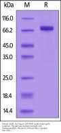 Human ACHE / Acetylcholinesterase Protein, His Tag (active enzyme)