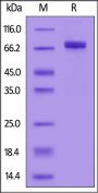 Human ACHE / Acetylcholinesterase Protein, His Tag (active enzyme)