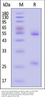 Anti-Human IgG Antibody-Acridinium ester (MALS verified)
