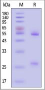Anti-Human IgG Antibody-Acridinium ester (MALS verified)
