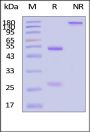 Monoclonal Anti-Human IgM mu Chain Antibody-Acridinium ester (M3HC) (MALS verified)