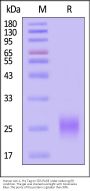 Human ALK-1 / ACVRL1 Protein, His Tag (MALS verified)