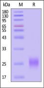 Human ALK-1 / ACVRL1 Protein, His Tag (MALS verified)