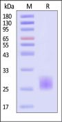 Human BMPR-1A / ALK-3 Protein, His Tag (MALS verified)