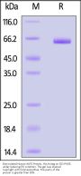 Biotinylated Human ALPG / ALPPL2 Protein, His,Avitag™ (MALS verified)