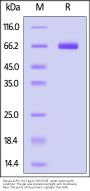 Mouse ALPG / ALPPL2 Protein, His Tag (active enzyme, MALS verified)