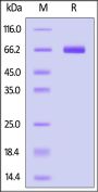 Mouse ALPG / ALPPL2 Protein, His Tag (active enzyme, MALS verified)