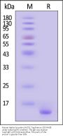 Human Alpha-Synuclein (A53T) Protein, Tag Free, low endotoxin (MALS verified)