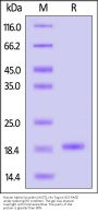 Human Alpha-Synuclein (A53T) Protein, His Tag (MALS verified)