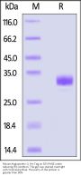 Mouse Angiopoietin-2 / ANGPT2 Protein, His Tag (MALS verified)