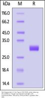 Rat Angiopoietin-2 / ANGPT2 Protein, His Tag (MALS verified)