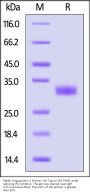 Rabbit Angiopoietin-2 / ANGPT2 Protein, His Tag (MALS verified)