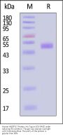 Human ANGPTL7 / CDT6 Protein, His Tag