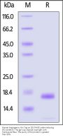 Human Angiogenin / RNASE5 Protein, His Tag (SPR verified)