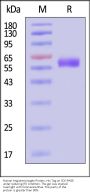 Human Angiotensinogen Protein, His Tag (MALS verified)