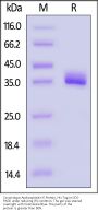Cynomolgus Apolipoprotein E Protein, His Tag (MALS & SPR verified)