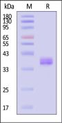 Human Apolipoprotein E / APOE4 Protein, Tag Free (MALS verified)