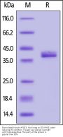 Biotinylated Human Apolipoprotein E / APOE3 Protein, His,Avitag™ (MALS verified)