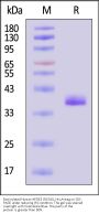 Biotinylated Human Apolipoprotein E / APOE3 (R154S) Protein, His,Avitag™ (MALS verified)