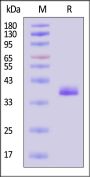 Biotinylated Human Apolipoprotein E / APOE3 (R154S) Protein, His,Avitag™ (MALS verified)