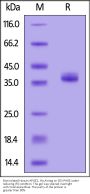 Biotinylated Human Apolipoprotein E / APOE2 Protein, His,Avitag™ (MALS verified)