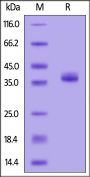 Biotinylated Human Apolipoprotein E / APOE2 Protein, His,Avitag™ (MALS verified)