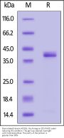 Biotinylated Human Apolipoprotein E / APOE4 Protein, His,Avitag™ (MALS verified)