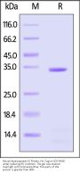 Mouse Apolipoprotein E Protein, His Tag (MALS & SPR verified)