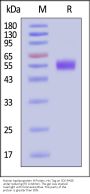 Human Apolipoprotein H Protein, His Tag (MALS verified)
