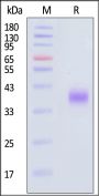 Cynomolgus ASGR1 Protein, His Tag