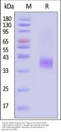 Human ASGR1 / ASGPR1 Protein, His Tag (MALS & SPR verified)