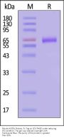 Mouse ASGR1 Protein, Fc Tag (MALS & SPR verified)