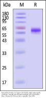 Rat ASGR1 / ASGPR1 Protein, Fc Tag