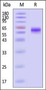 Rat ASGR1 / ASGPR1 Protein, Fc Tag