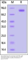 Biotinylated Human AXL Protein, Fc,Avitag™ (MALS verified)