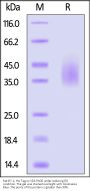 Rat B7-1 / CD80 Protein, His Tag (MALS verified)
