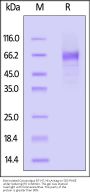 Biotinylated Cynomolgus B7-H7 / HHLA2 Protein, His,Avitag™